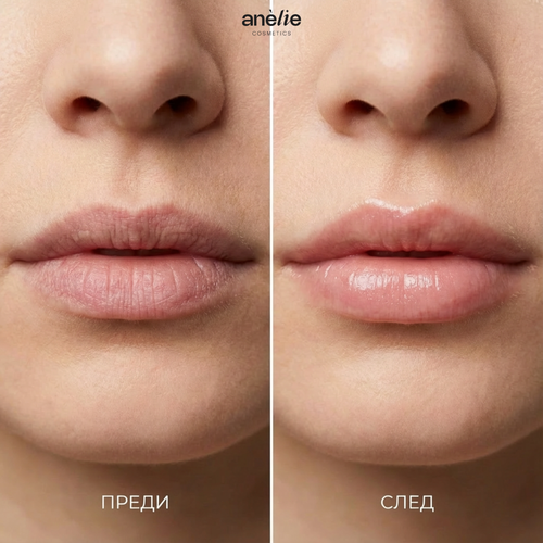 Anèlie Lip Veil — daytime lip balm